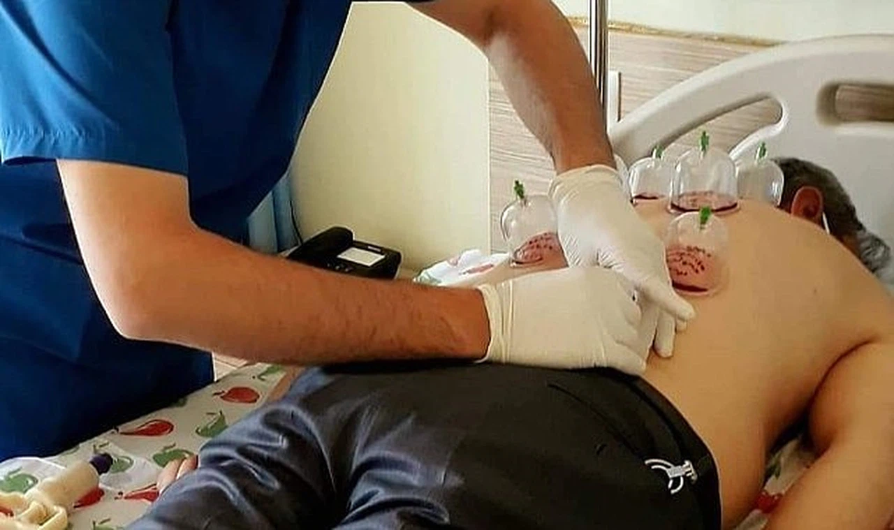 Uzmanlardan "hacamat" uyarısı: “Yanlış uygulamalar ömür boyu geçmeyen ağrılar oluşturuyor”