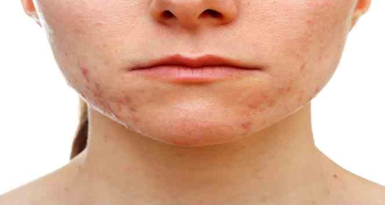 Kaşıntı öksürük döküntü varsa dikkat