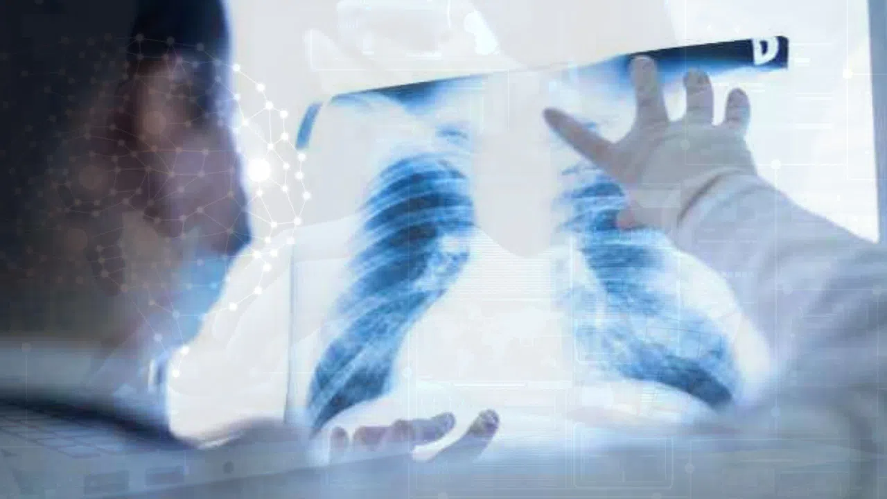 Türk Bilim İnsanından Kansere Devrim Gibi Gelişme!