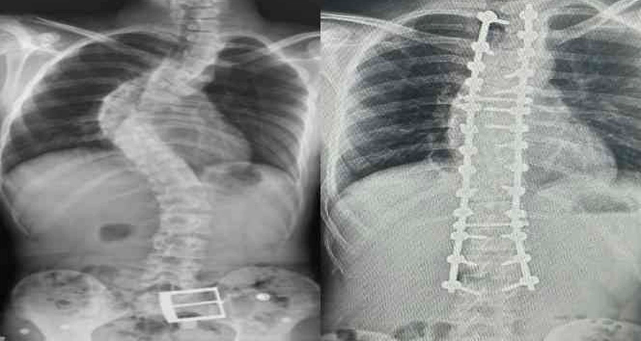 Çocuğunuzun Duruşunda Bu Detaylara Dikkat!