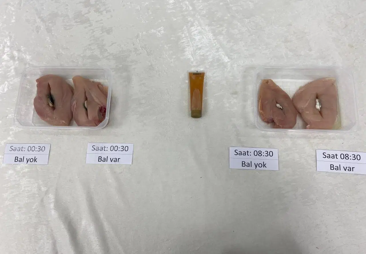 Evinizdeki O Masum Eşya Tehlikeli Olabilir! Hemen Bantlayın!