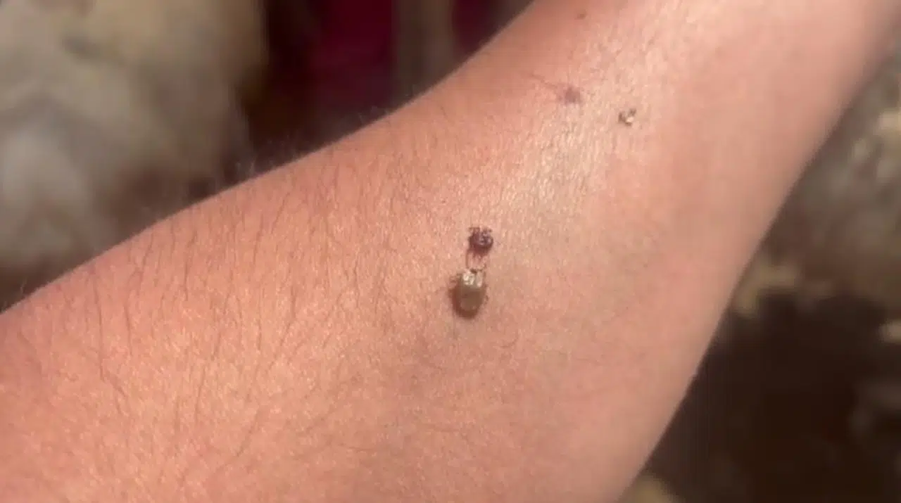 Yaşlılar ve çocuklar tehlikede!