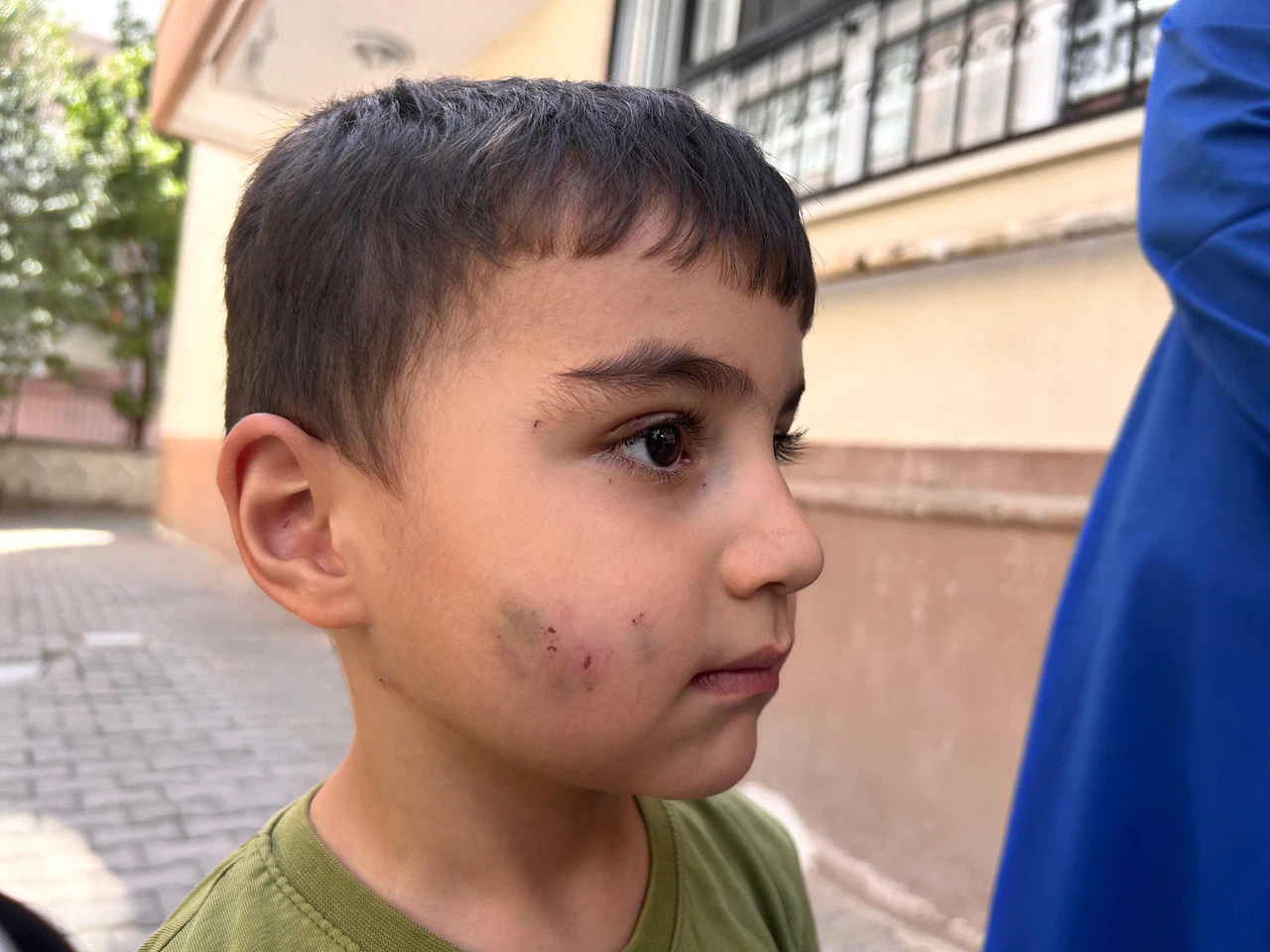 Evde uyuyan çocuğu lağım faresi ısırdı!