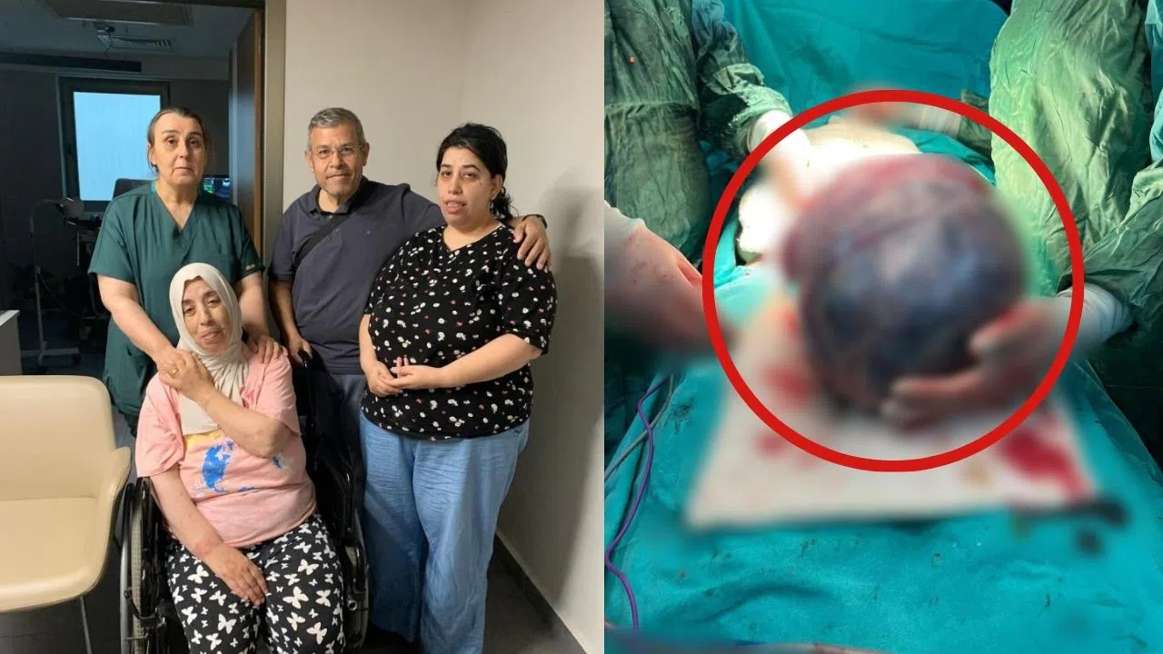 52 yaşındaki kadının karnından 40 santimlik kitle çıktı