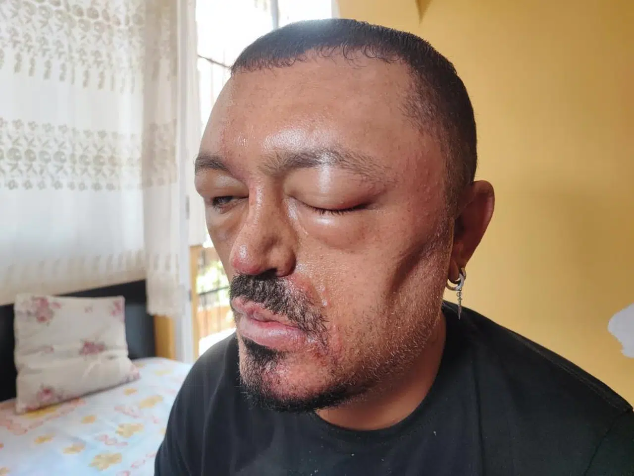 İnternetten Aldığı Şampuanla Gelen Kabus!