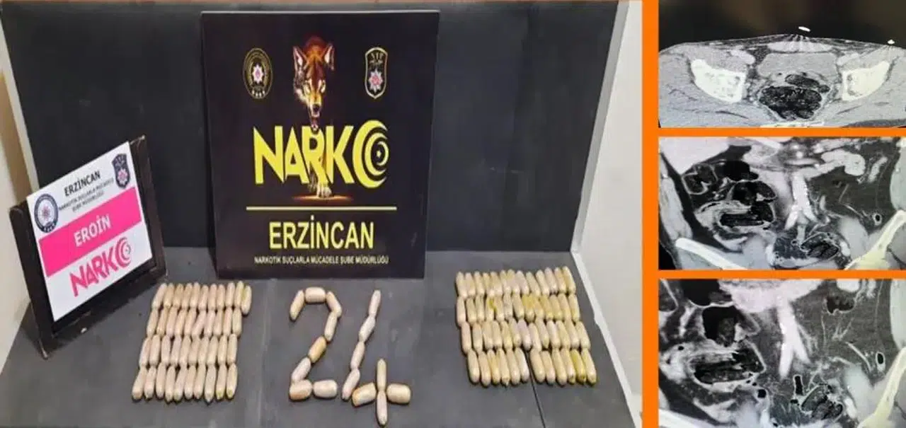 Midelerinde sakladılar polisten kaçamadılar!