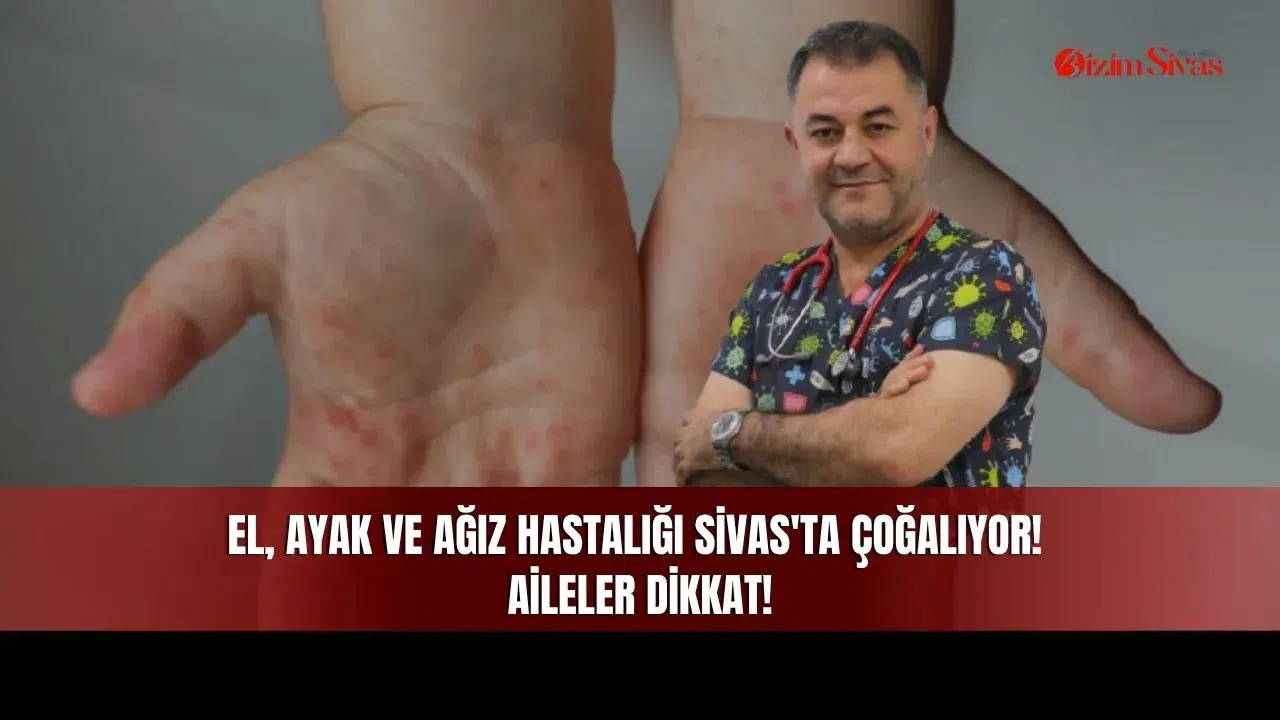 El, ayak ve ağız hastalığı Sivas'ta çoğalıyor! Aileler dikkat!