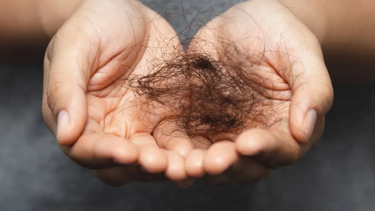 Sadece Kemikleri Değil Saçları da Döküyor! Kış Aylarının Gizli Tehlikesi!