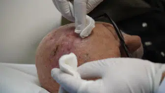 Milyarda Bir İhtimal Türkiye'de Gerçek Oldu!