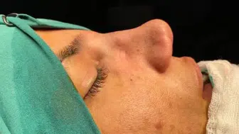 Kusursuz Burun İçin Altın Oran Efsanesi Bitiyor Mu? Ameliyat Masasına Yatmadan Önce Mutlaka Okuyun