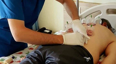 Uzmanlardan "hacamat" uyarısı: “Yanlış uygulamalar ömür boyu geçmeyen ağrılar oluşturuyor”