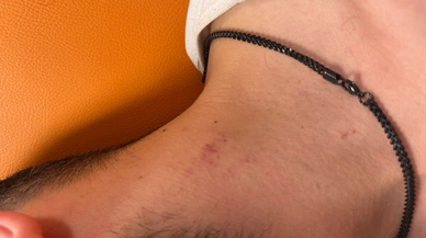 Sivas'ta Epilepsi Hastasına Şiddet İddiası