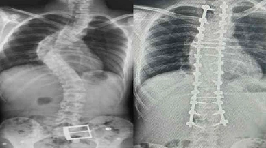 Çocuğunuzun Duruşunda Bu Detaylara Dikkat!