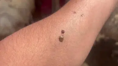 Yaşlılar ve çocuklar tehlikede!