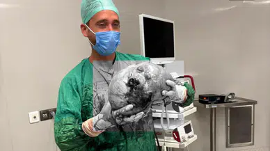 Karın Ağrısıyla Gitti Doktorlar Gördüklerine İnanamadı