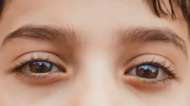 O belirti göze sıçradıysa hemen doktora gidin!