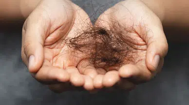 Sadece Kemikleri Değil Saçları da Döküyor! Kış Aylarının Gizli Tehlikesi!