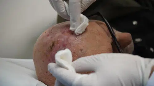 Milyarda Bir İhtimal Türkiye'de Gerçek Oldu!