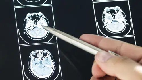 İngiltere Kapılarını Açtı! MS’in Kaderini Değiştirecek O Proje!