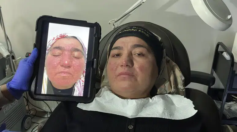 Sivas’ta Tedaviyle 20 Yıl Sonra Hayata Döndü