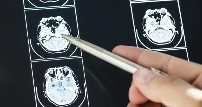 İngiltere Kapılarını Açtı! MS’in Kaderini Değiştirecek O Proje!