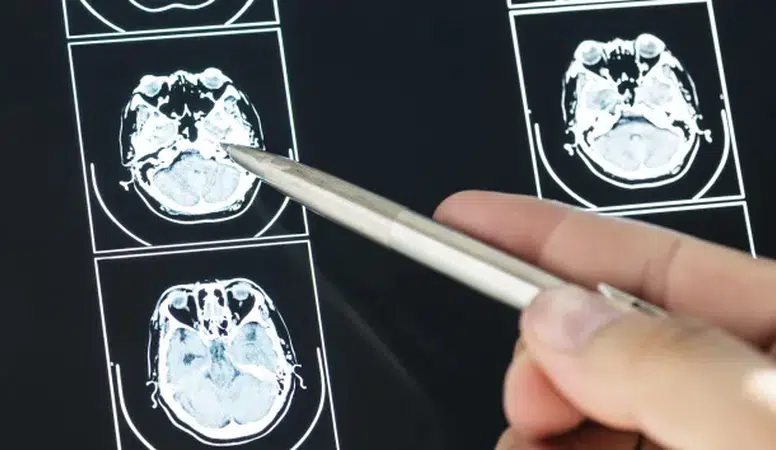 İngiltere Kapılarını Açtı! MS’in Kaderini Değiştirecek O Proje!